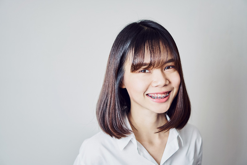 young woman smiling with traditional braces orthodontics