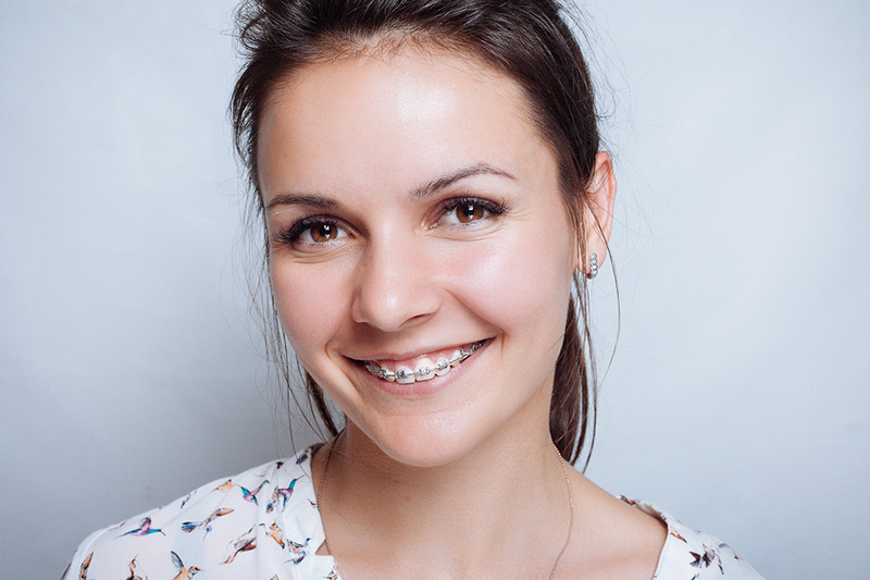 Young woman with dental braces