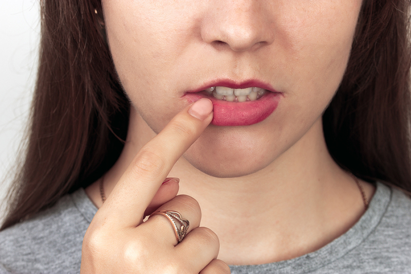 woman pointing to her teeth closeup