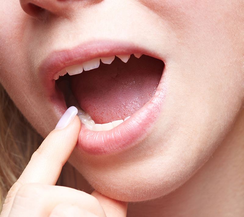 Woman with pain in her mouth holding finger to teeth